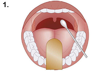 Test Procedure - Oropharyngeal (Mouth) Swab Method
